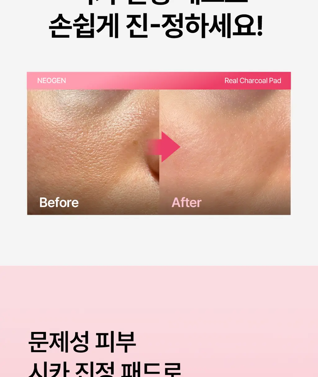 [진정패드/대용량] 네오젠 카밍 시카&티트리 진정 토너 패드 90매 상세페이지 5